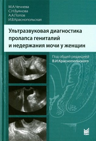 Ультразвуковая диагностика пролапса гениталий и недержания мочи у женщин. 3-е изд фото книги