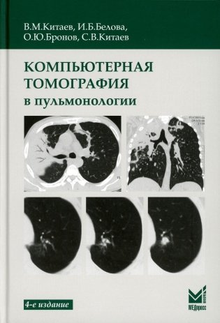 Компьютерная томография в пульмонологии. 4-е изд фото книги