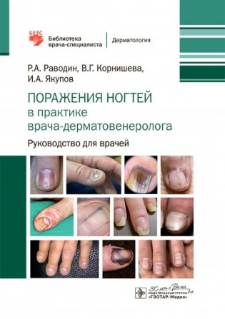 Поражения ногтей в практике врача-дерматовенеролога. Руководство для врачей фото книги