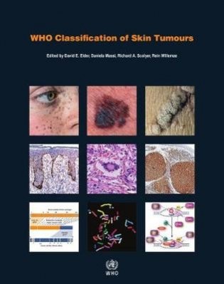 Who Classification of Skin Tumours фото книги