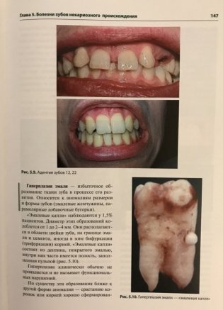 Терапевтическая стоматология фото книги 6