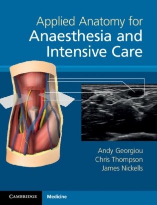 Applied Anatomy for Anaesthesia and Intensive Care фото книги