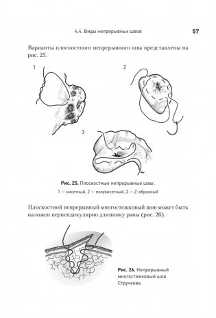 Хирургический шов. 3-е издание, обновленное фото книги 13
