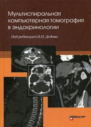 Мультиспиральная компьютерная томография в эндокринологии. Руководство фото книги