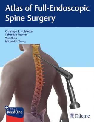 Atlas of Full-Endoscopic Spine Surgery фото книги
