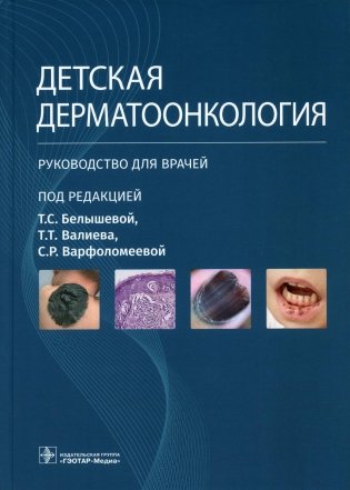 Детская дерматоонкология: руководство для врачей фото книги