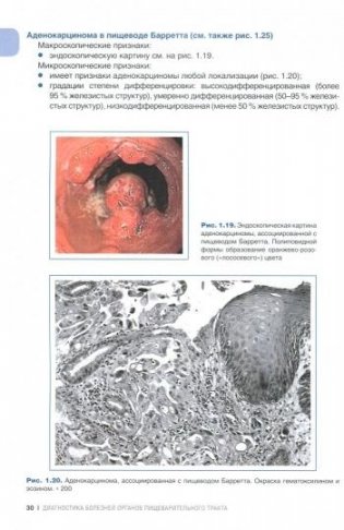 Прижизненная патолого-анатомическая диагностика болезней органов пищеварительной системы (класс XI МКБ-10). Руководство для врачей фото книги 2