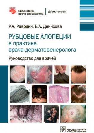 Рубцовые алопеции в практике врача-дерматовенеролога фото книги
