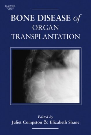 Bone Disease of Organ Transplantation, фото книги