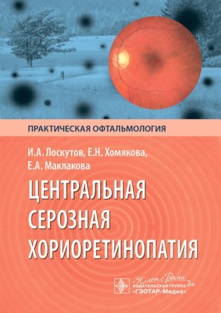 Центральная серозная хориоретинопатия фото книги