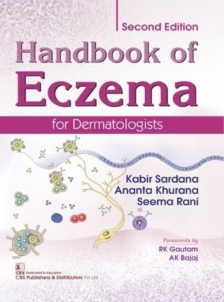 Handbook Of Eczema For Dermatologists 2Ed (Hb 2019) фото книги