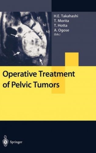 Operative Treatment of Pelvic Tumors фото книги