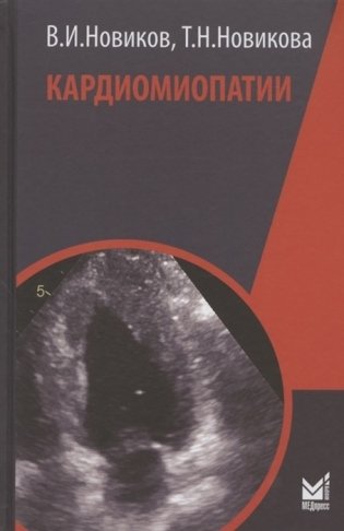Кардиомиопатии фото книги
