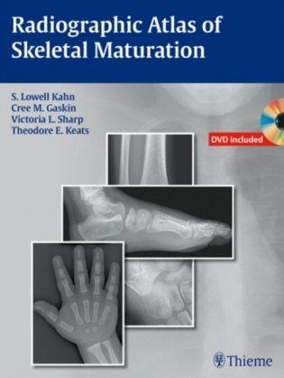 Radiographic Atlas of Skeletal Maturation фото книги