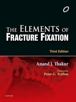 The Elements of Fracture Fixation фото книги