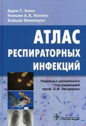 Атлас респираторных инфекций фото книги