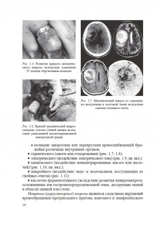 Хирургические болезни. Часть 1 фото книги 11