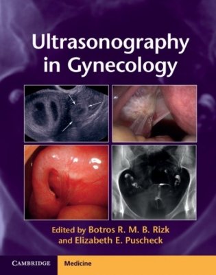 Ultrasonography in Gynecology фото книги