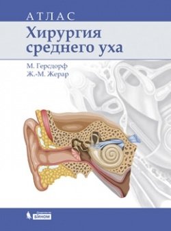 Хирургия среднего уха. Атлас фото книги