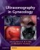 Ultrasonography in Gynecology фото книги маленькое 2