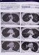 Рентгенологическое исследование грудной клетки фото книги маленькое 9