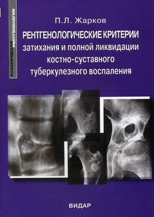 Рентгенологические критерии затихания и полной ликвидации костно-суставного туберкулезного воспаления фото книги
