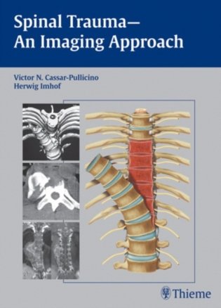 Spinal Trauma - An Imaging Approach фото книги