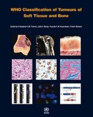 WHO Classification of Tumours of Soft Tissue and Bone. Fourth edition фото книги