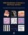 WHO Classification of Tumours of Soft Tissue and Bone. Fourth edition фото книги маленькое 2