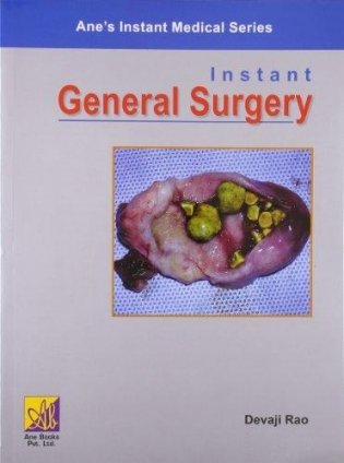 Instant General Surgery фото книги