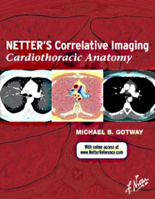 Netter s Correlative Imaging: Cardiothoracic Anatomy, фото книги