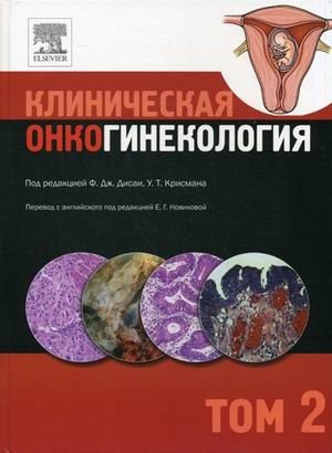 Клиническая онкогинекология. В 3-х томах. Том 2 фото книги
