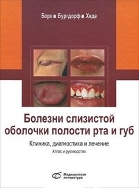 Болезни слизистой оболочки полости рта и губ. Клиника, диагностика и лечение фото книги