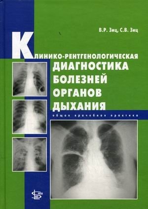 Клинико-рентгенологическая диагностика болезней органов дыхания. Общая врачебная практика фото книги