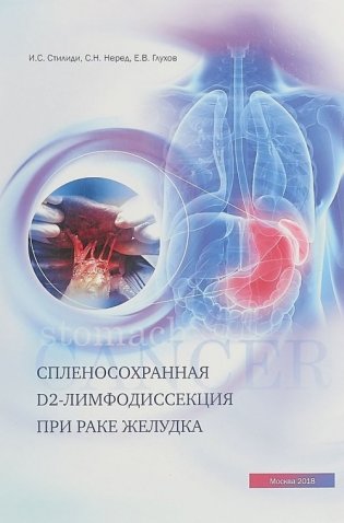 Спленосохранная D2-лимфодиссекция при раке желудка фото книги