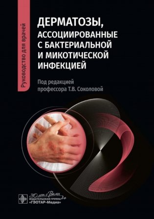 Дерматозы, ассоциированные с бактериальной и микотической инфекцией: руководство для врачей фото книги