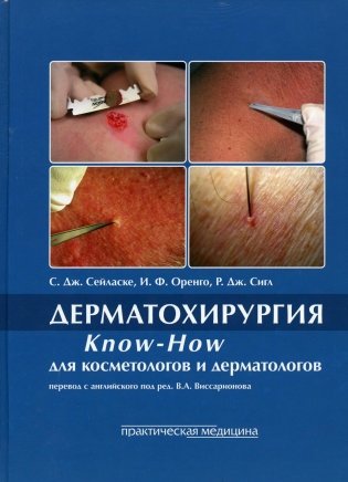 Дерматохирургия. Know-How для косметологов и дерматологов фото книги
