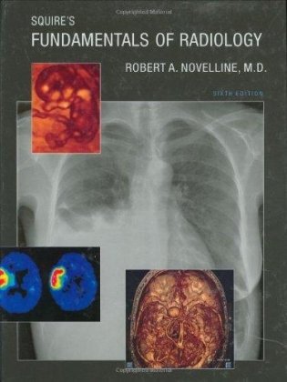 Squire's Fundamentals of Radiology фото книги