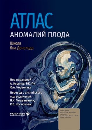 Атлас аномалий плода. Школа Яна Дональда фото книги