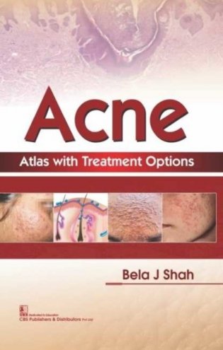Acne Atlas With Treatment Options (Hb 2018) фото книги
