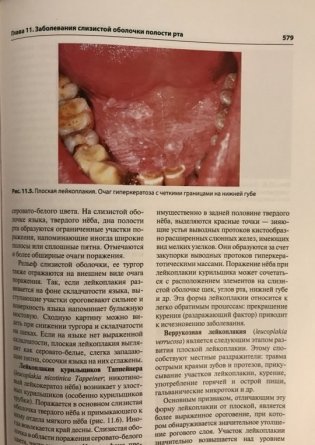 Терапевтическая стоматология фото книги 3