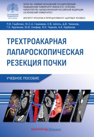 Трехтроакарная лапароскопическая резекция почки: Учебное пособие фото книги