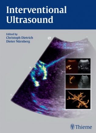 Interventional Ultrasound: A Practical Guide and Atlas фото книги