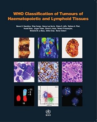 WHO Classification of Tumours of Haematopoietic and Lymphoid Tissues фото книги