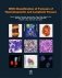 WHO Classification of Tumours of Haematopoietic and Lymphoid Tissues фото книги маленькое 2