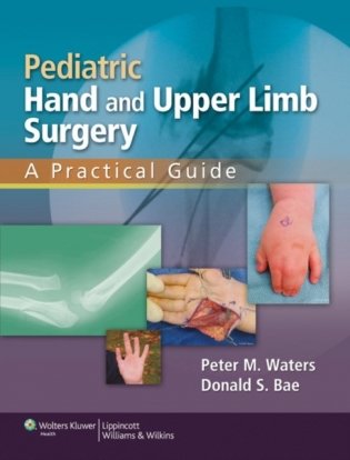Pediatric hand & upper limb surgery cb фото книги