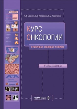 Курс онкологии в рисунках, таблицах и схемах: учебное пособие фото книги
