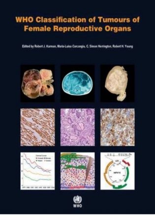 WHO Classification of Tumours of the Lung, Pleura, Thymus and Heart. 4 ed. фото книги