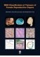 WHO Classification of Tumours of the Lung, Pleura, Thymus and Heart. 4 ed. фото книги маленькое 2