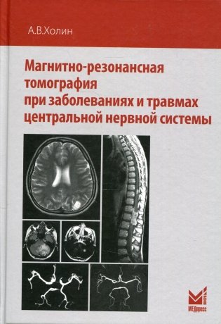 Магнитно-резонансная томография при заболеваниях и травмах центральной нервной системы. 2-е изд фото книги